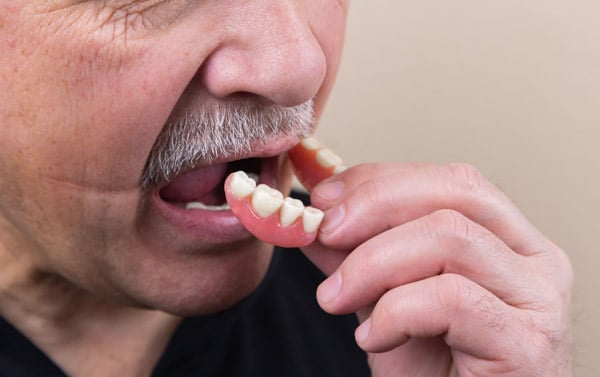 The differences between dental bridges, dentures, and dental implants