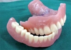 dentures