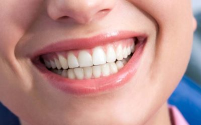 What is gum graft surgery?